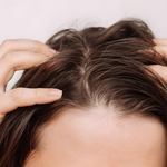 العناية بالفروة الدهنية والقشرة